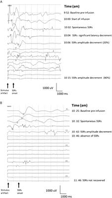 Desensitizing the autonomic nervous system to mitigate anti-GD2 monoclonal antibody side effects